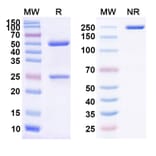 SDS-PAGE - Atibuclimab Biosimilar - Anti-CD14 Antibody - BSA and Azide free (A338495) - Antibodies.com