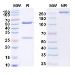 SDS-PAGE - Erlizumab Biosimilar - Anti-CD18 Antibody - BSA and Azide free (A338496) - Antibodies.com