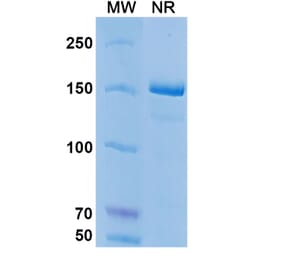 SDS-PAGE - Coltuximab Biosimilar - Anti-CD19 Antibody - BSA and Azide free (A338498) - Antibodies.com