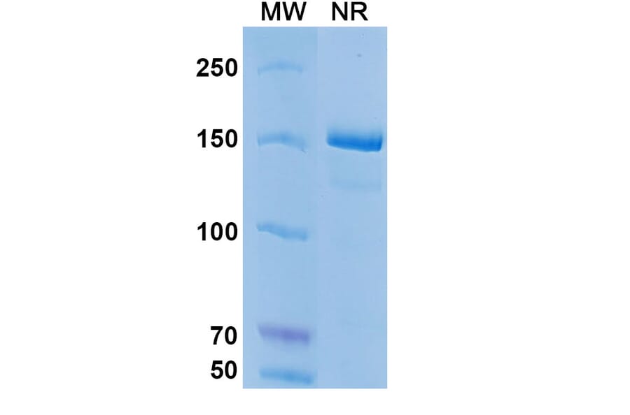 SDS-PAGE - Coltuximab Biosimilar - Anti-CD19 Antibody - BSA and Azide free (A338498) - Antibodies.com