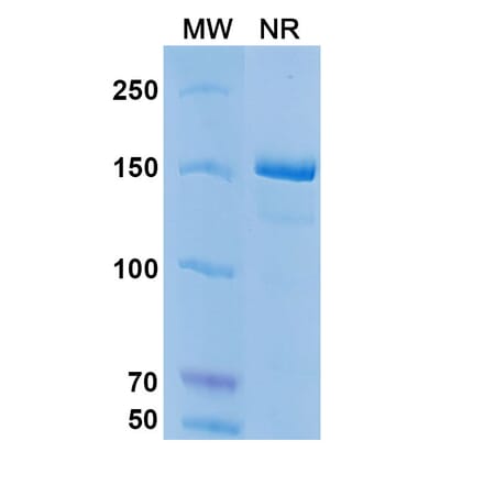 SDS-PAGE - Coltuximab Biosimilar - Anti-CD19 Antibody - BSA and Azide free (A338498) - Antibodies.com