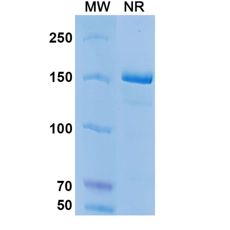 SDS-PAGE - Coltuximab Biosimilar - Anti-CD19 Antibody - BSA and Azide free (A338498) - Antibodies.com