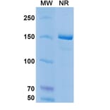 SDS-PAGE - Coltuximab Biosimilar - Anti-CD19 Antibody - BSA and Azide free (A338498) - Antibodies.com