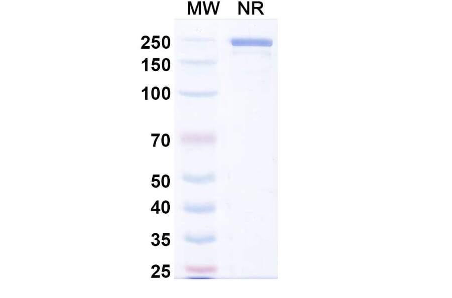SDS-PAGE - Ublituximab Biosimilar - Anti-CD20 Antibody - BSA and Azide free (A338502) - Antibodies.com