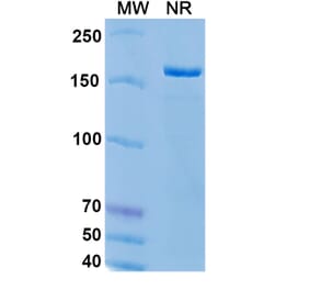 SDS-PAGE - Epratuzumab Biosimilar - Anti-CD22 Antibody - BSA and Azide free (A338512) - Antibodies.com