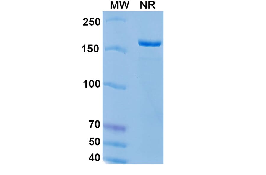 SDS-PAGE - Epratuzumab Biosimilar - Anti-CD22 Antibody - BSA and Azide free (A338512) - Antibodies.com