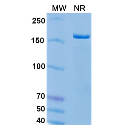 SDS-PAGE - Epratuzumab Biosimilar - Anti-CD22 Antibody - BSA and Azide free (A338512) - Antibodies.com