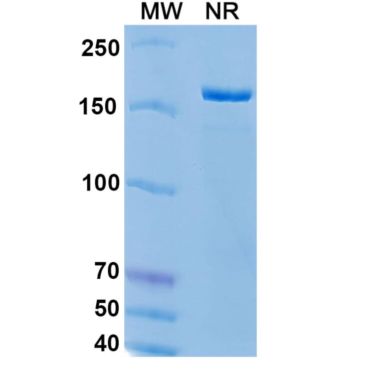 SDS-PAGE - Epratuzumab Biosimilar - Anti-CD22 Antibody - BSA and Azide free (A338512) - Antibodies.com