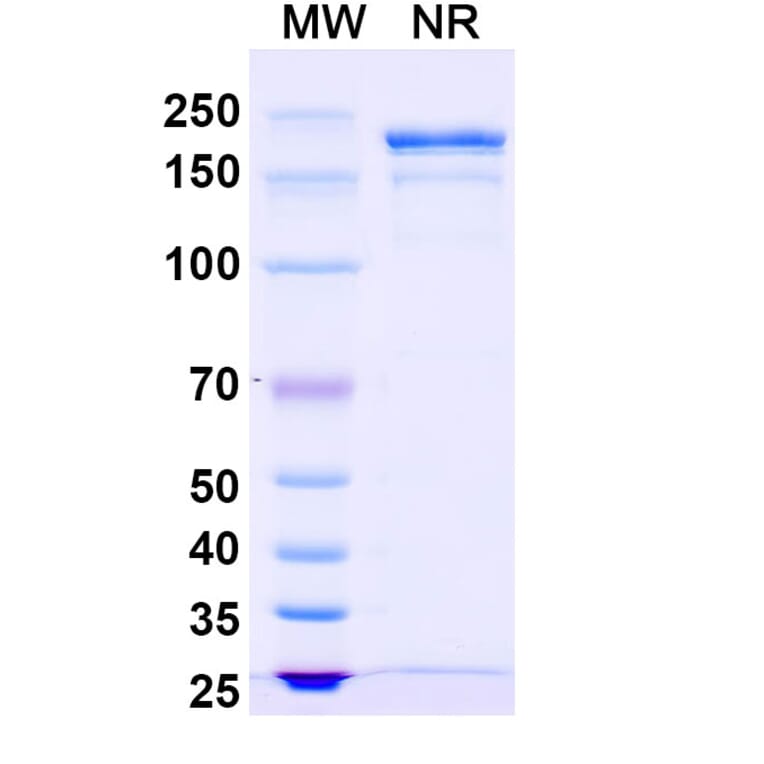 SDS-PAGE - Gomiliximab Biosimilar - Anti-CD23 Antibody - BSA and Azide free (A338517) - Antibodies.com