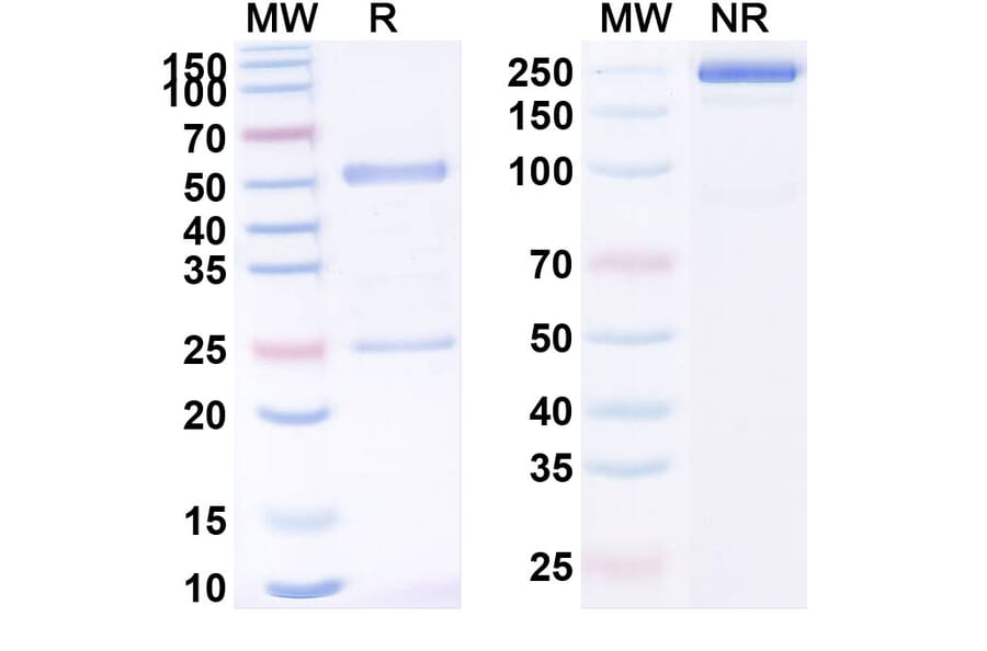 SDS-PAGE - Begelomab Biosimilar - Anti-CD26 Antibody - BSA and Azide free (A338519) - Antibodies.com