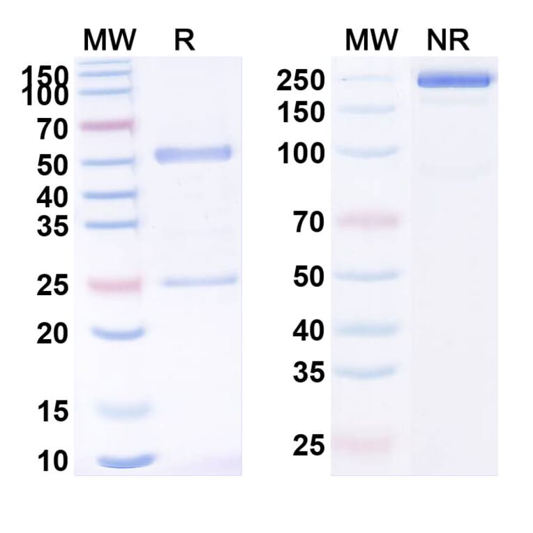 SDS-PAGE - Begelomab Biosimilar - Anti-CD26 Antibody - BSA and Azide free (A338519) - Antibodies.com