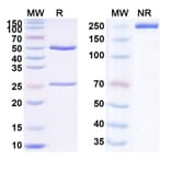 SDS-PAGE - Vadastuximab Biosimilar - Anti-CD33 Antibody - BSA and Azide free (A338524) - Antibodies.com