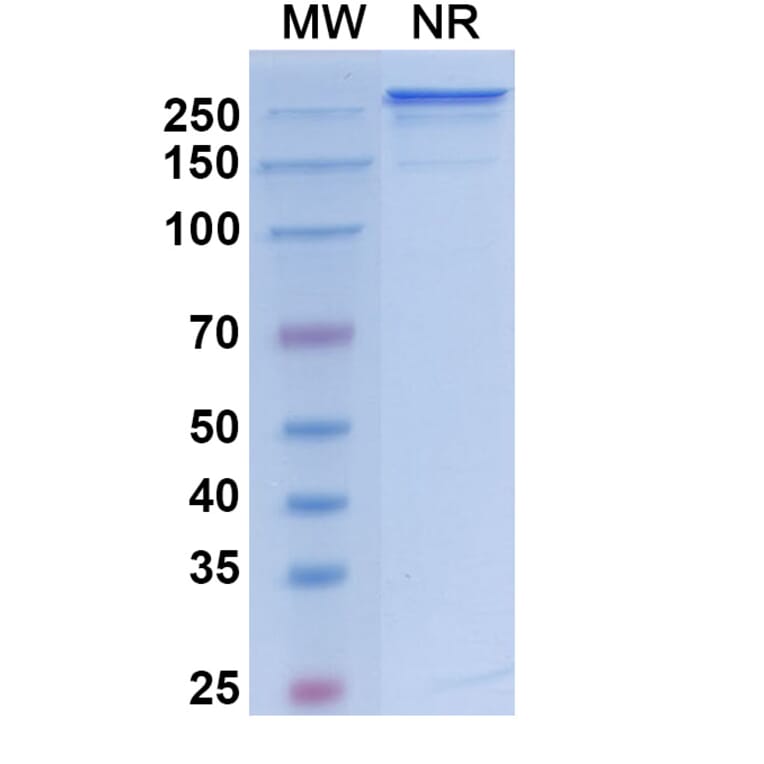 SDS-PAGE - Vanalimab Biosimilar - Anti-CD40 Antibody - BSA and Azide free (A338537) - Antibodies.com