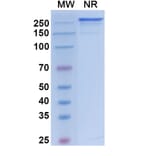 SDS-PAGE - Vanalimab Biosimilar - Anti-CD40 Antibody - BSA and Azide free (A338537) - Antibodies.com