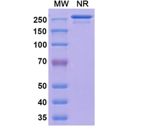 SDS-PAGE - Vatelizumab Biosimilar - Anti-Integrin alpha 2 Antibody - BSA and Azide free (A338545) - Antibodies.com