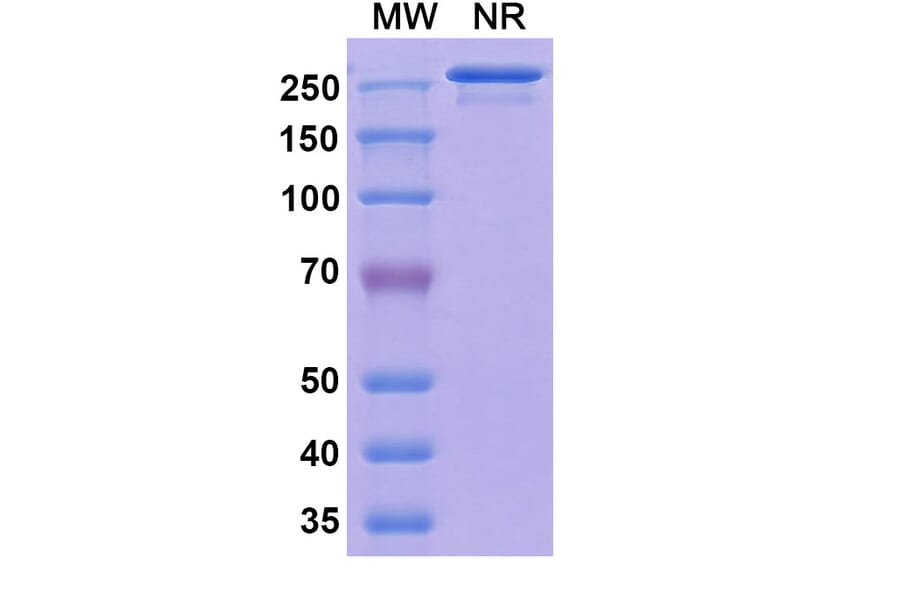SDS-PAGE - Vatelizumab Biosimilar - Anti-Integrin alpha 2 Antibody - BSA and Azide free (A338545) - Antibodies.com