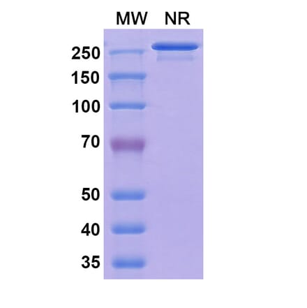 SDS-PAGE - Vatelizumab Biosimilar - Anti-Integrin alpha 2 Antibody - BSA and Azide free (A338545) - Antibodies.com