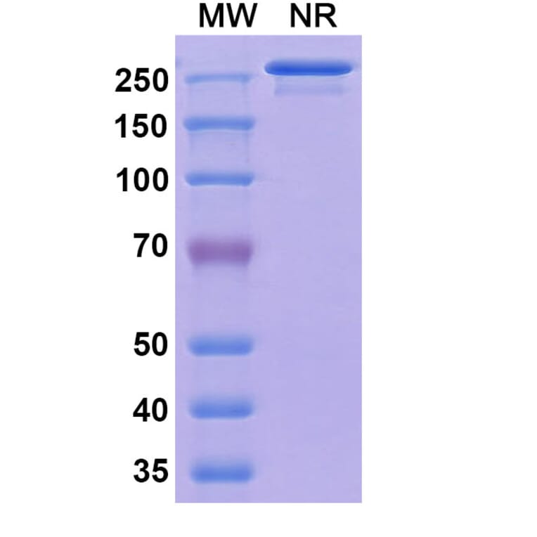 SDS-PAGE - Vatelizumab Biosimilar - Anti-Integrin alpha 2 Antibody - BSA and Azide free (A338545) - Antibodies.com