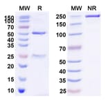 SDS-PAGE - Tinurilimab Biosimilar - Anti-CEACAM6 Antibody - BSA and Azide free (A338559) - Antibodies.com