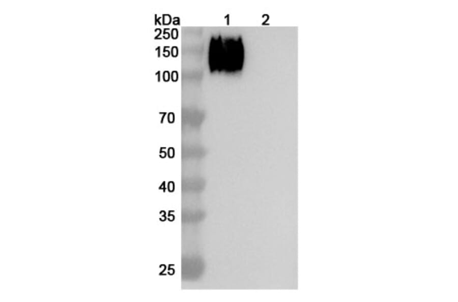 SDS-PAGE - Altumomab Biosimilar - Anti-CEA Antibody - BSA and Azide free (A338565) - Antibodies.com