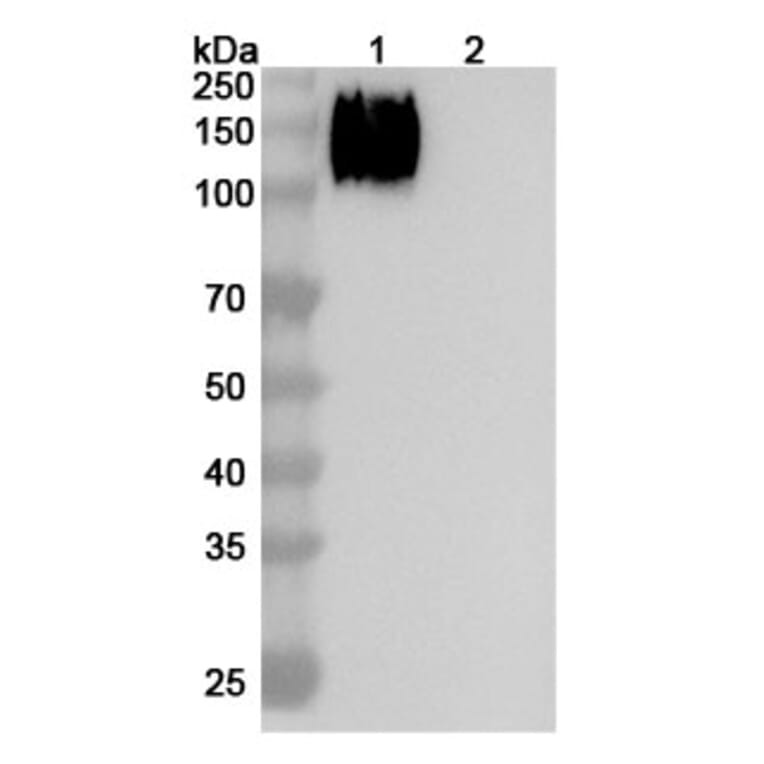 SDS-PAGE - Altumomab Biosimilar - Anti-CEA Antibody - BSA and Azide free (A338565) - Antibodies.com