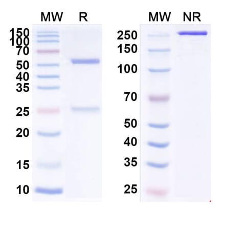 SDS-PAGE - Vorsetuzumab Biosimilar - Anti-CD70 Antibody - BSA and Azide free (A338567) - Antibodies.com