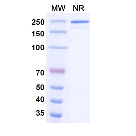 SDS-PAGE - Milatuzumab Biosimilar - Anti-CD74 Antibody - BSA and Azide free (A338570) - Antibodies.com