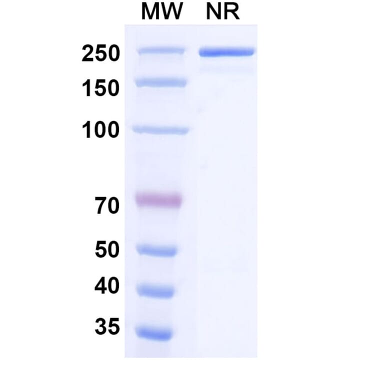 SDS-PAGE - Milatuzumab Biosimilar - Anti-CD74 Antibody - BSA and Azide free (A338570) - Antibodies.com