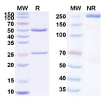 SDS-PAGE - Carotuximab Biosimilar - Anti-CD105 Antibody - BSA and Azide free (A338576) - Antibodies.com