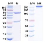 SDS-PAGE - Talacotuzumab Biosimilar - Anti-CD123 Antibody - BSA and Azide free (A338581) - Antibodies.com
