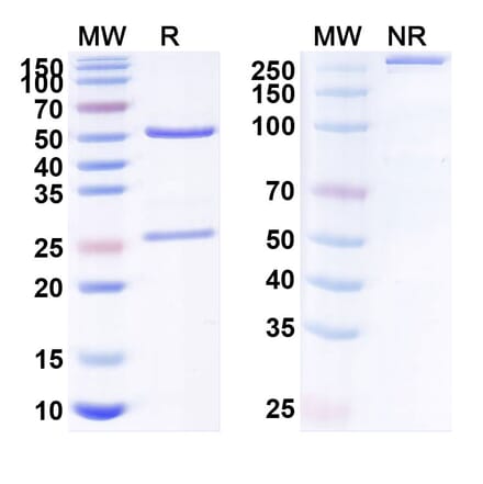 SDS-PAGE - Rinucumab Biosimilar - Anti-PDGFR beta Antibody - BSA and Azide free (A338597) - Antibodies.com