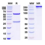 SDS-PAGE - Meplazumab Biosimilar - Anti-CD147 Antibody - BSA and Azide free (A338600) - Antibodies.com