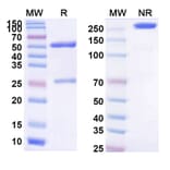 SDS-PAGE - Gavilimomab Biosimilar - Anti-CD147 Antibody - BSA and Azide free (A338602) - Antibodies.com