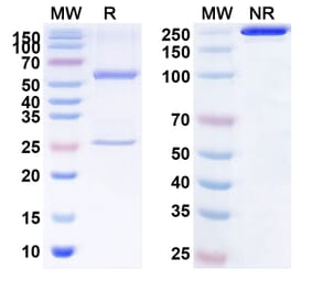 SDS-PAGE - Lacutamab Biosimilar - Anti-KIR3DL2 Antibody - BSA and Azide free (A338612) - Antibodies.com