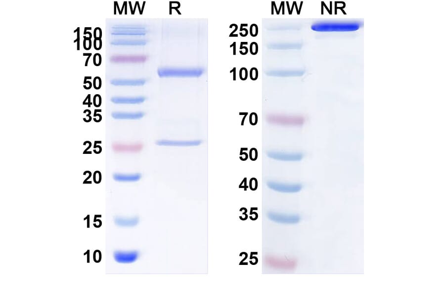 SDS-PAGE - Lacutamab Biosimilar - Anti-KIR3DL2 Antibody - BSA and Azide free (A338612) - Antibodies.com