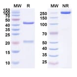 SDS-PAGE - Atorolimumab Biosimilar - Anti-RhD Antibody - BSA and Azide free (A338637) - Antibodies.com