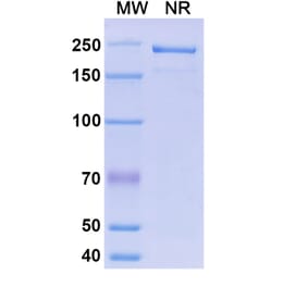 SDS-PAGE - Morolimumab Biosimilar - Anti-RhD Antibody - BSA and Azide free (A338638) - Antibodies.com