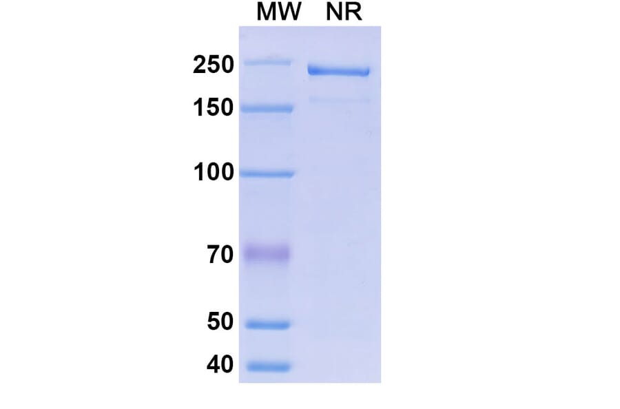 SDS-PAGE - Morolimumab Biosimilar - Anti-RhD Antibody - BSA and Azide free (A338638) - Antibodies.com