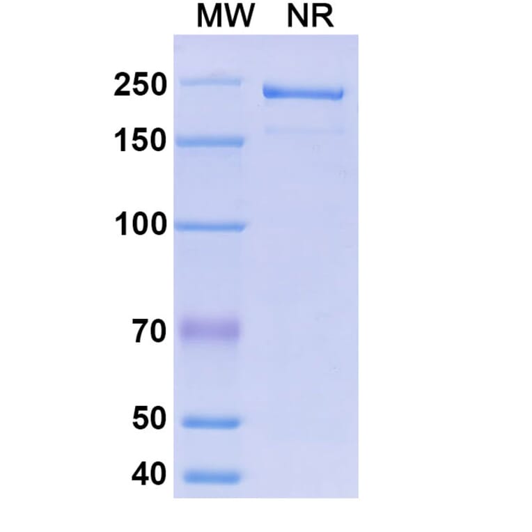 SDS-PAGE - Morolimumab Biosimilar - Anti-RhD Antibody - BSA and Azide free (A338638) - Antibodies.com