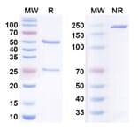 SDS-PAGE - Budigalimab Biosimilar - Anti-PD 1 Antibody - BSA and Azide free (A338673) - Antibodies.com