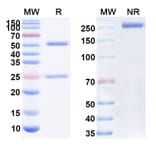 SDS-PAGE - Alacizumab Biosimilar - Anti-VEGF Receptor 2 Antibody - BSA and Azide free (A338686) - Antibodies.com