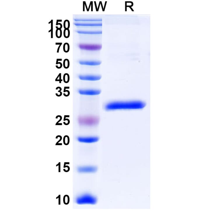 SDS-PAGE - Gancotamab Biosimilar - Anti-ErbB2 Antibody - BSA and Azide free (A338701) - Antibodies.com