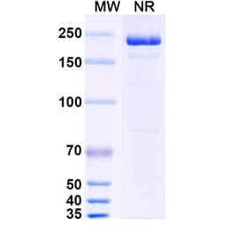 SDS-PAGE - Cobolimab Biosimilar - Anti-TIM 3 Antibody - BSA and Azide free (A338707) - Antibodies.com