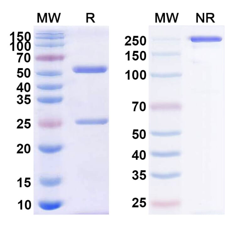 SDS-PAGE - Zalutumumab Biosimilar - Anti-EGFR Antibody - BSA and Azide free (A338723) - Antibodies.com