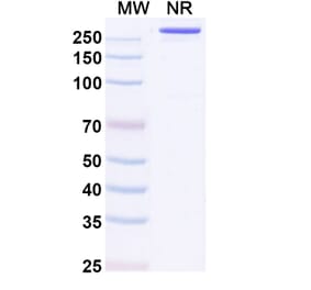 SDS-PAGE - Pimurutamab Biosimilar - Anti-EGFR Antibody - BSA and Azide free (A338724) - Antibodies.com
