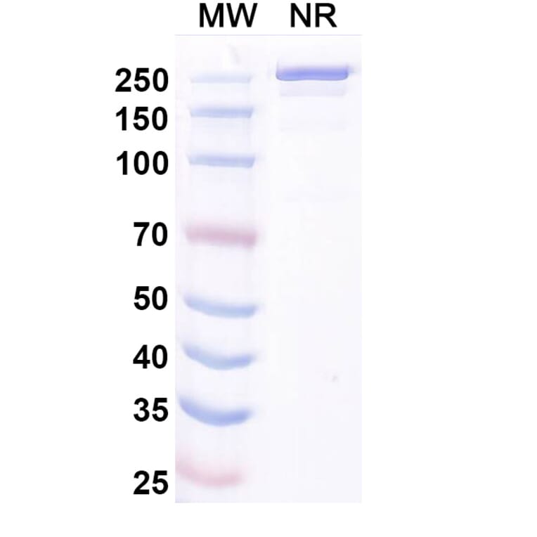 SDS-PAGE - Pimurutamab Biosimilar - Anti-EGFR Antibody - BSA and Azide free (A338724) - Antibodies.com