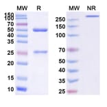 SDS-PAGE - Vilobelimab Biosimilar - Anti-C5 Antibody - BSA and Azide free (A338735) - Antibodies.com