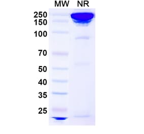SDS-PAGE - Concizumab Biosimilar - Anti-TFPI Antibody - BSA and Azide free (A338740) - Antibodies.com