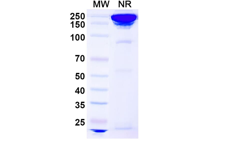 SDS-PAGE - Concizumab Biosimilar - Anti-TFPI Antibody - BSA and Azide free (A338740) - Antibodies.com
