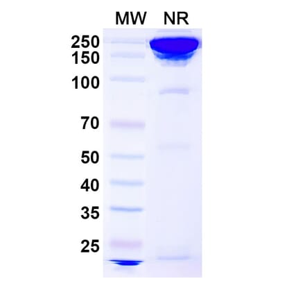SDS-PAGE - Concizumab Biosimilar - Anti-TFPI Antibody - BSA and Azide free (A338740) - Antibodies.com